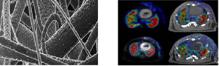 Biomedical Image
